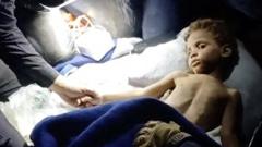 Niño de 3 años rescatado con vida tras seis días bajo los escombros del terremoto Venezuela