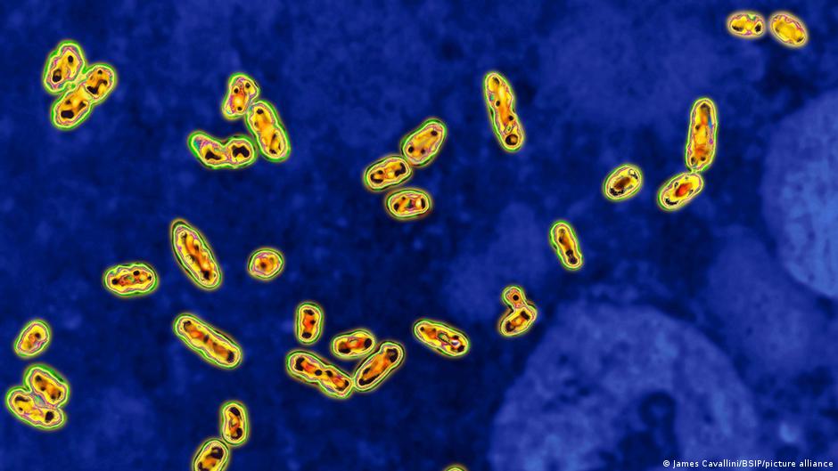 Médico analizando radiografía de pulmones afectados por peste neumónica